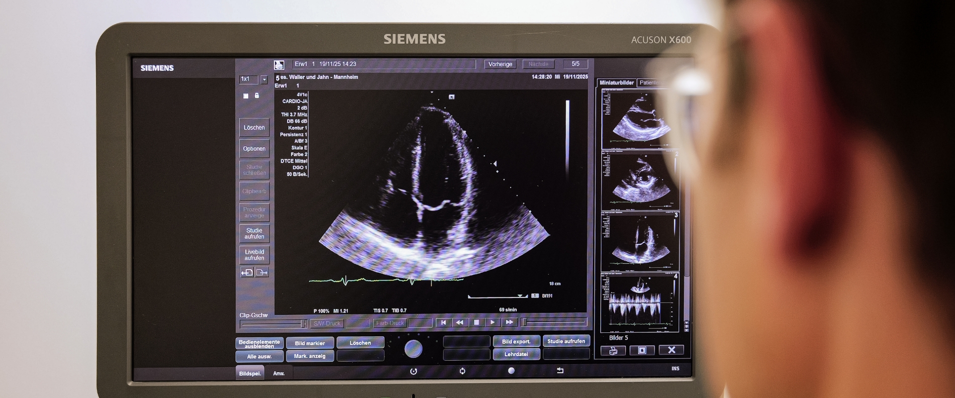Arzt von hinten schaut auf einen Ultraschall-Monitor